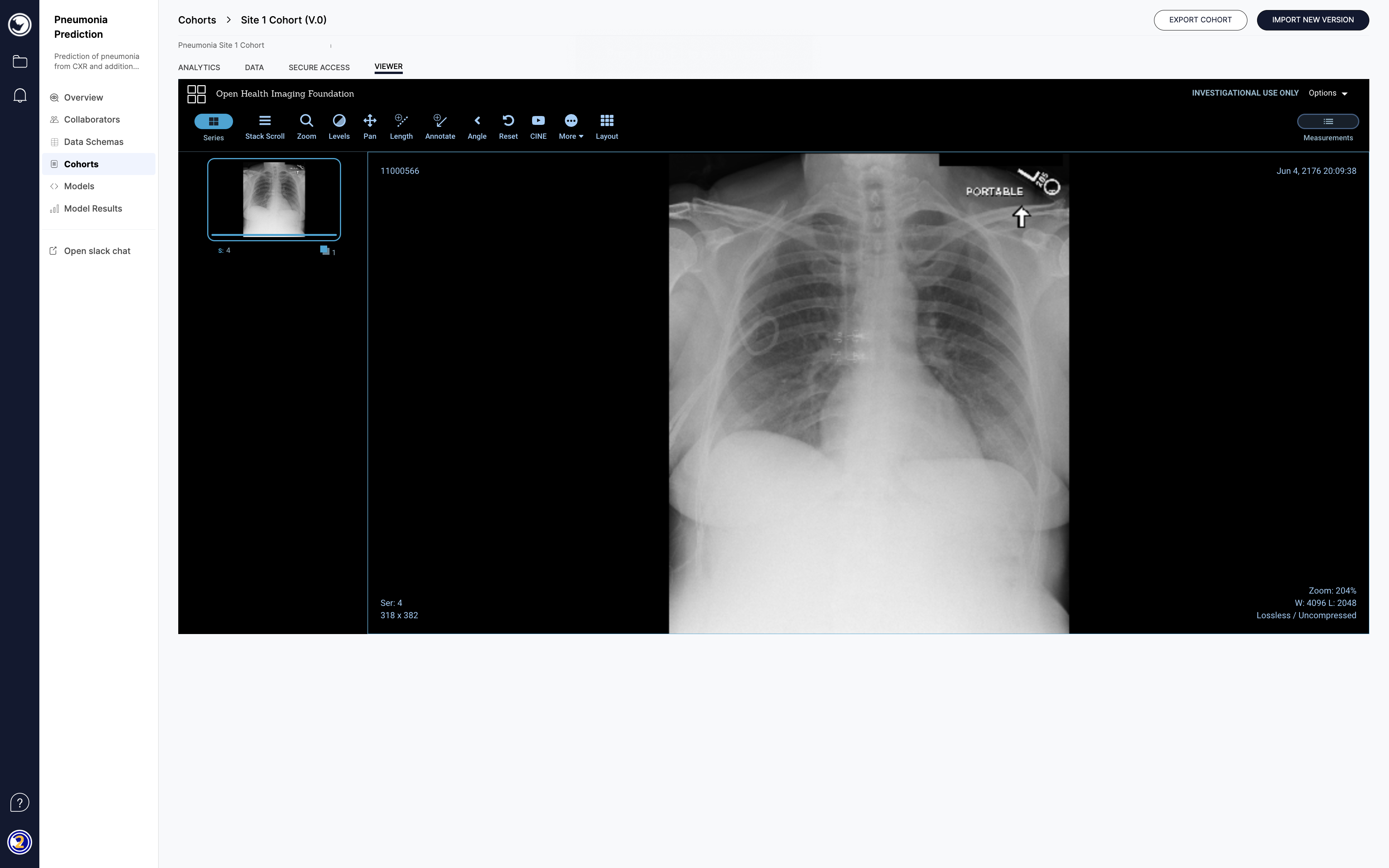 Secure Access Viewing an Image in OHIF Viewer.png