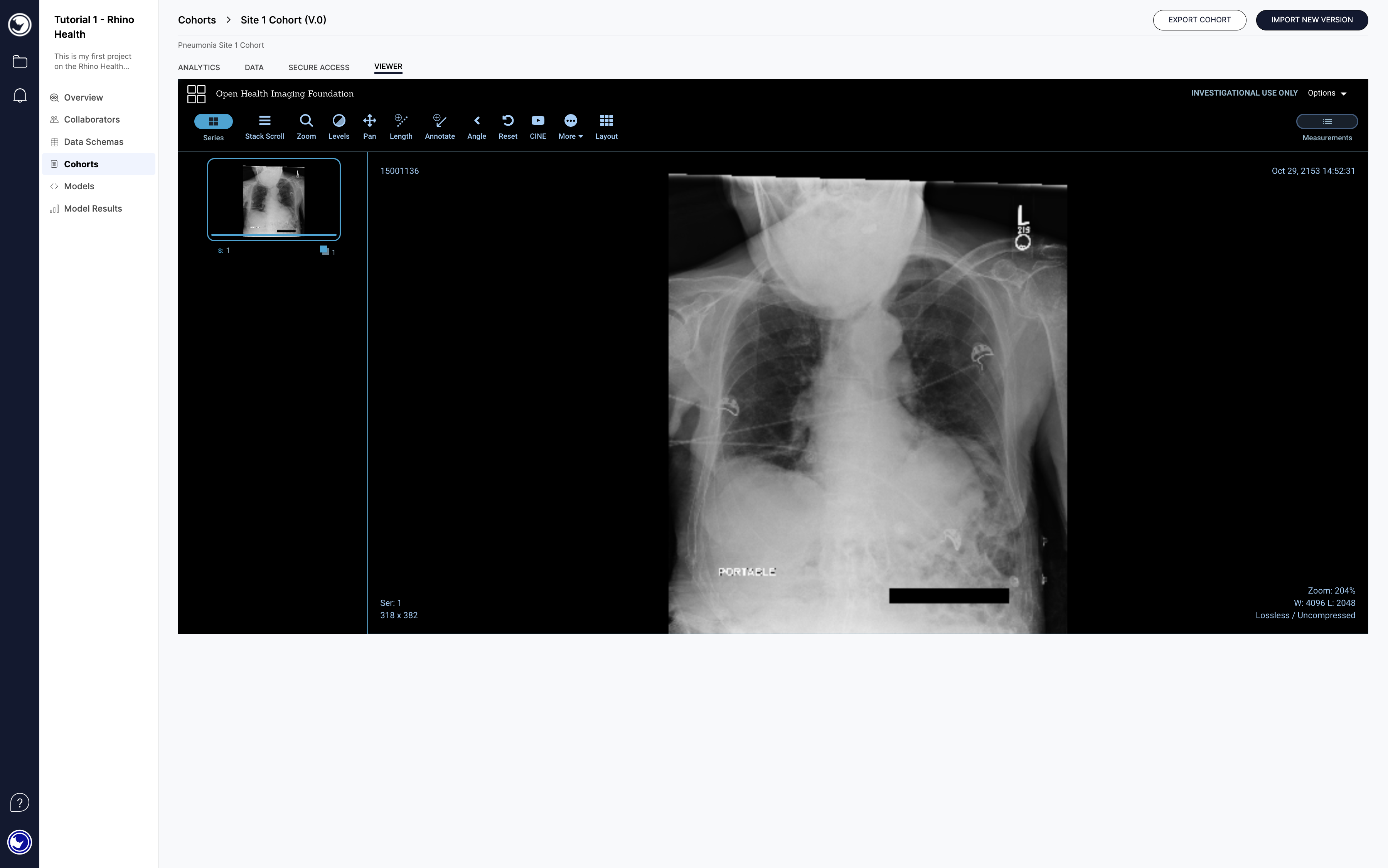 Cohort OHIF Viewer.png